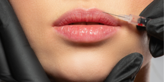 عوارض تزریق بوتاکس را بشناسید