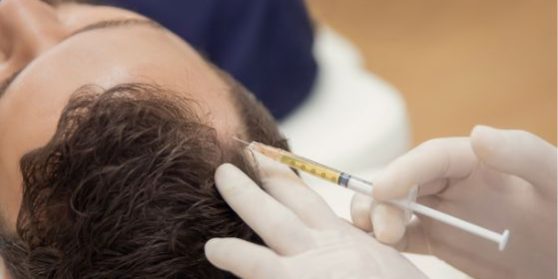 مزومو درماهیل